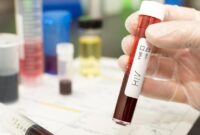 1769144749787-ilustrasi-hiv-1754528560118_169